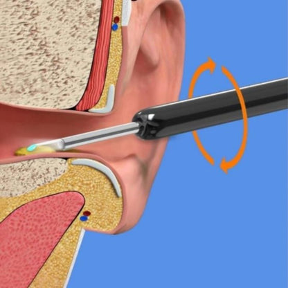 Wireless Earwax Remover Otoscope Tool 5