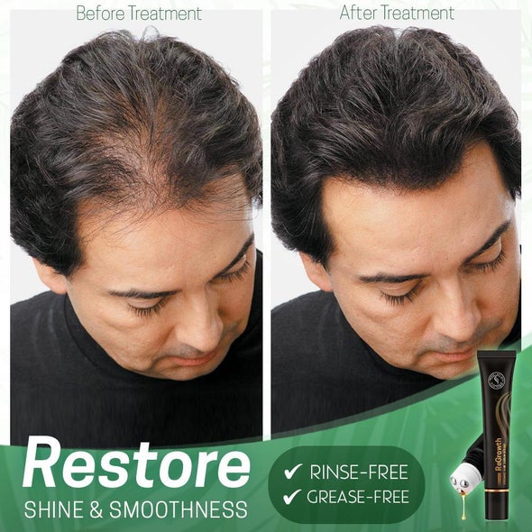 Organic Hair Serum Roller 5