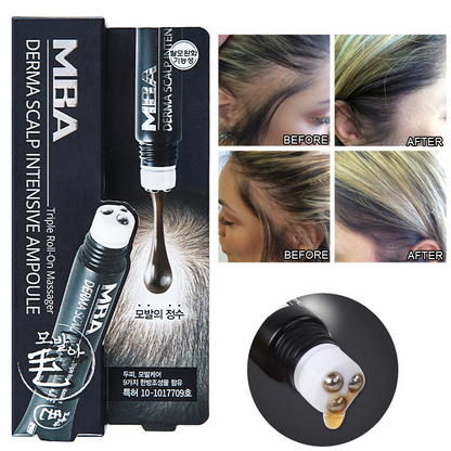 Scalp Intense  Roll-on Hair Growth Serum 5