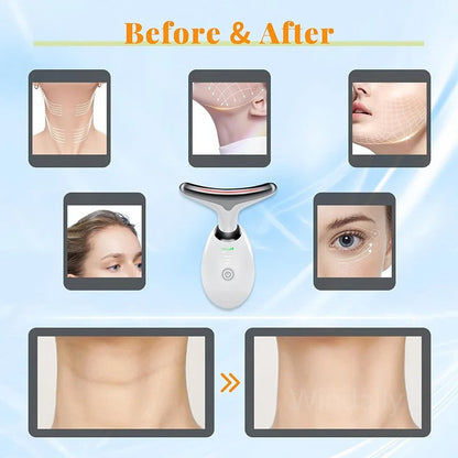 Anti Wrinkle Facial Massager 5
