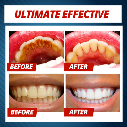 Natural Intensive Stain Remover Whitening Toothpaste 5