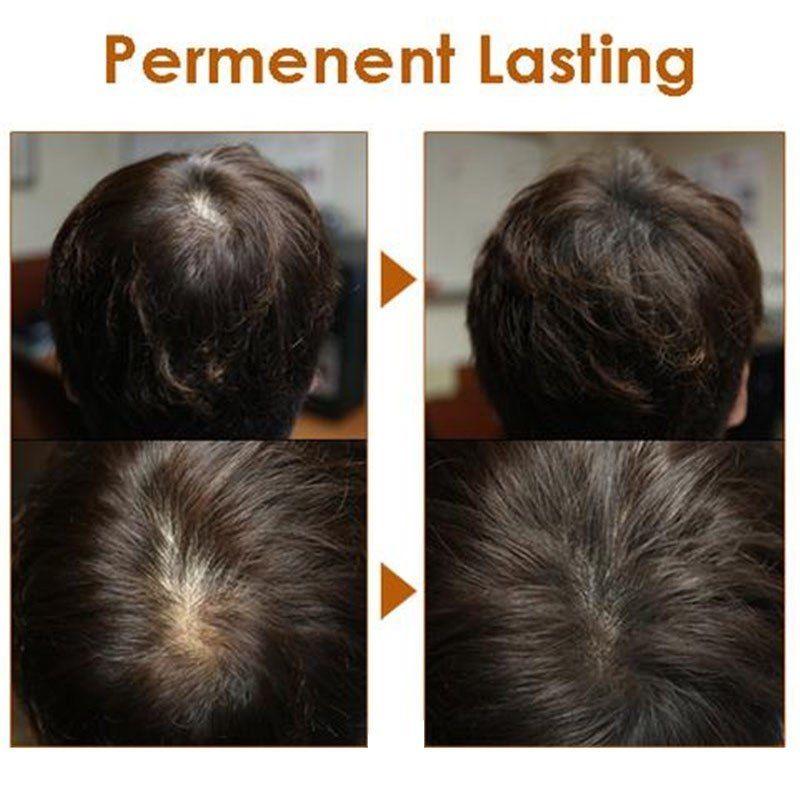 Natural Herb White Hair Cover Pen 5