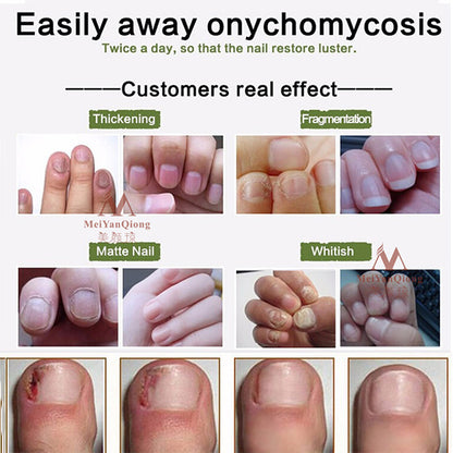 Nail Repair Cream 5