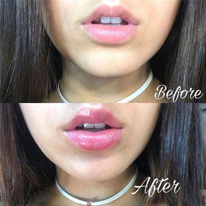 Magic Lips™ Lip Plumper 5