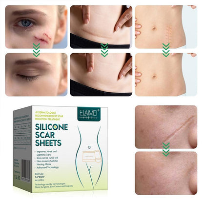 Medical Soft Silicone Gel Tape for Scar Removal 5