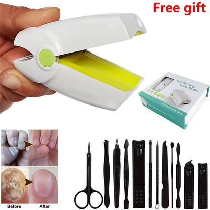 Portable Fungus Nail Laser 5