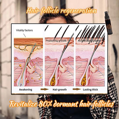 Hair Regrowth Essence Intensive Spray 5