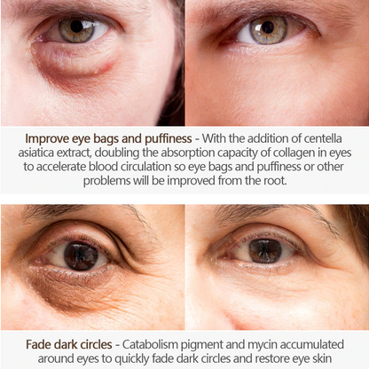 Magic Eye Cream 5