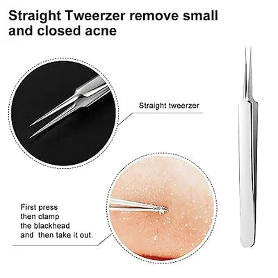 Professional Ultra-fine No.5 Acne Blackhead Removal Tweezers (Pcs 3) 5