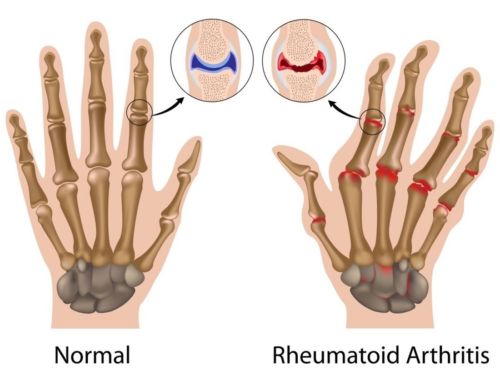Copper Compression Therapy Hand Gloves 5