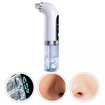 Hydrodermabrasion 5