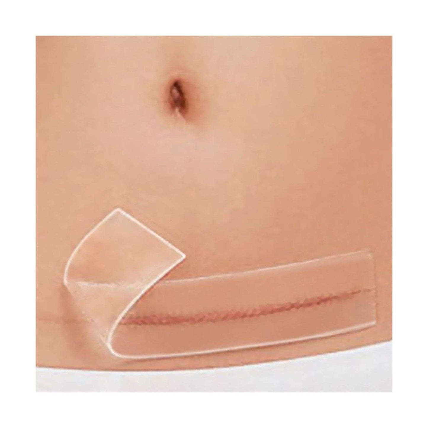 Silicone Scar Removal Patch 5