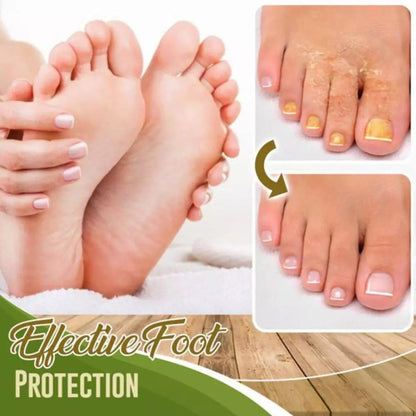 Anti-Fungal Treatment Spray 6