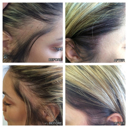 Scalp Intense  Roll-on Hair Growth Serum 6