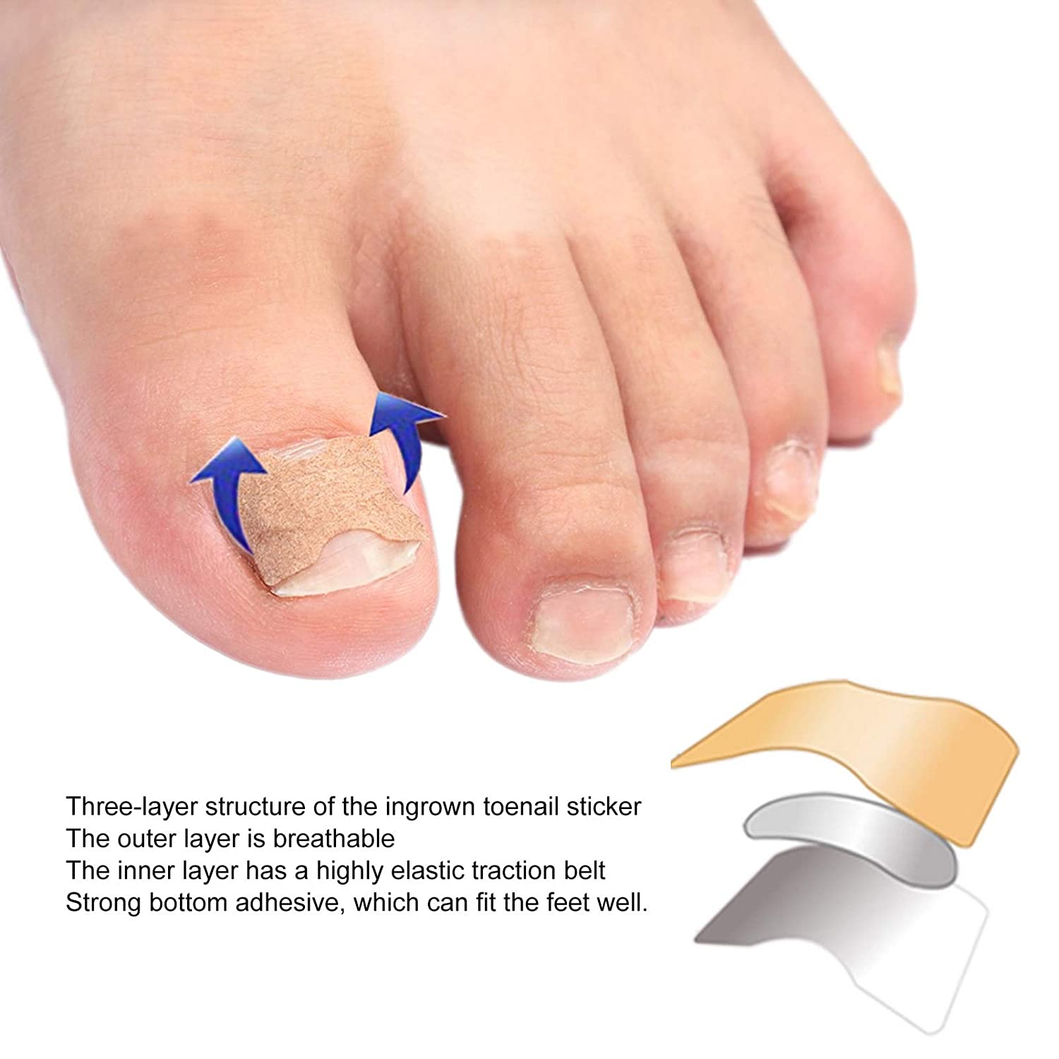 Ingrown Toenail Corrector Patches 6