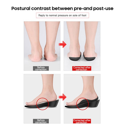 Flat Foot Orthopedic Insoles 6