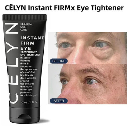 Firm Eye Tightener 6