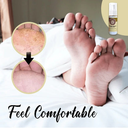 Fungal combat feet spray 6