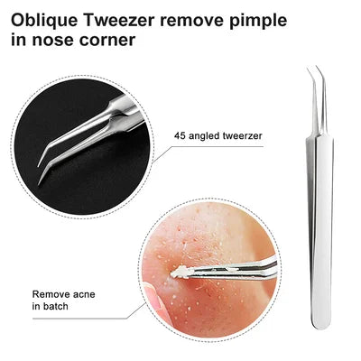 Professional Ultra-fine No.5 Acne Blackhead Removal Tweezers (Pcs 3) 6