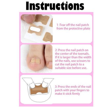 Ingrown Toenail Corrector Patches 7