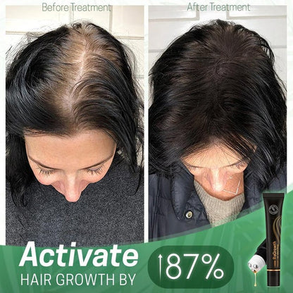 Organic Hair Serum Roller 7