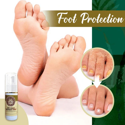 Fungal combat feet spray 8