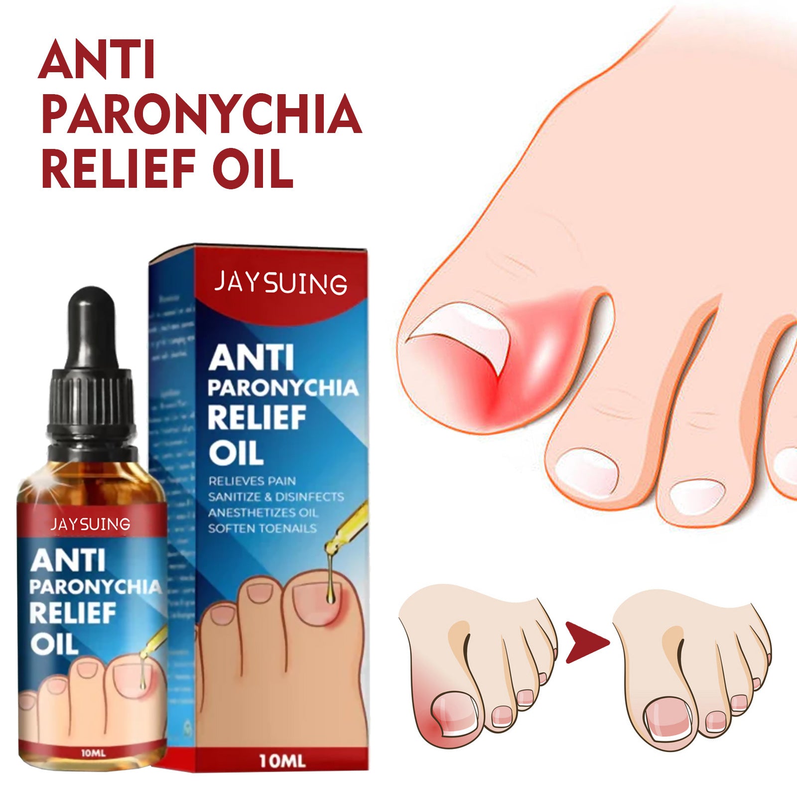 Anti Paronychia Relief Oil 1