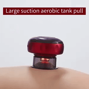 Cupping Massage Device 1