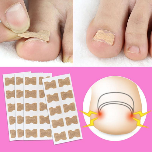 Glue Free Toenail Patch 1