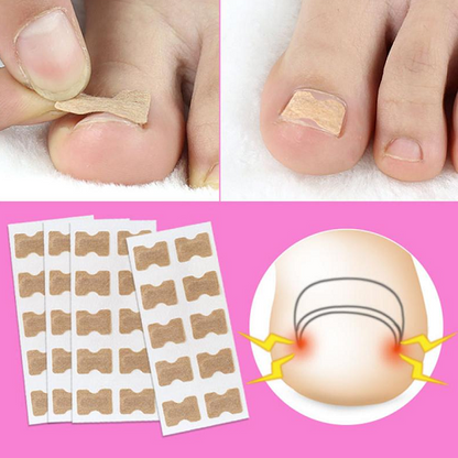 Glue Free Toenail Patch 1