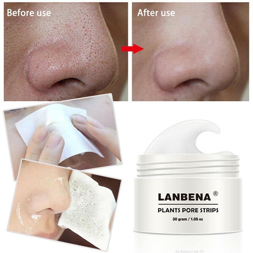 BLACKHEAD STRIP 1