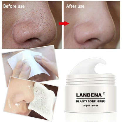 BLACKHEAD STRIP 1