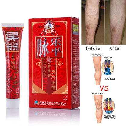 Varicose Veins Treatment Cream 1