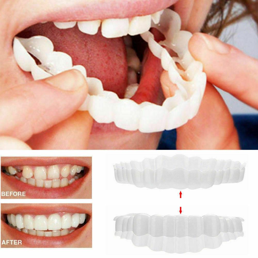 Smart Smile 1