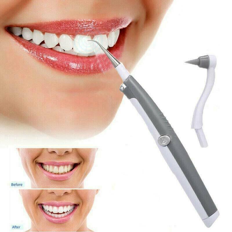 Sonic Scaler Ultrasonic Tooth Stain/Plaque Remover 1