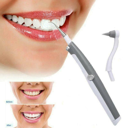 Sonic Scaler Ultrasonic Tooth Stain/Plaque Remover 1