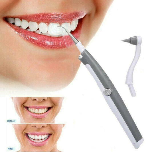 Sonic Scaler Ultrasonic Tooth Stain/Plaque Remover 1