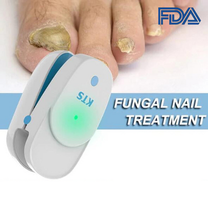 Antifungal Laser Device 1