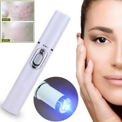 Skin Spots Removal Laze Pen 1