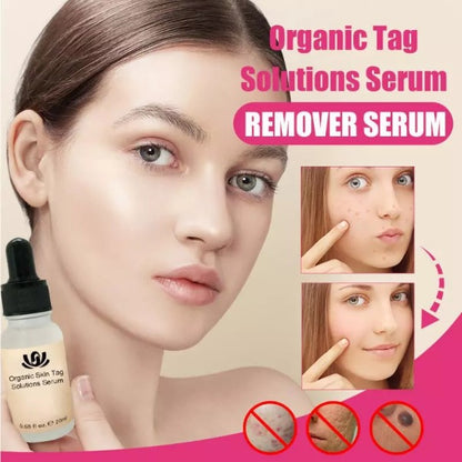 Organic Skin Spot Purifying Serum 1
