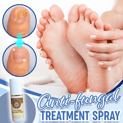 Fungal combat feet spray 1