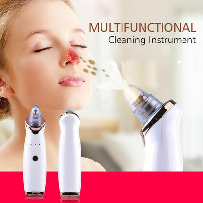 Blackhead Remover Vacuum 1