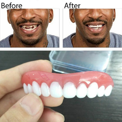 Perfect Instant Smile 1