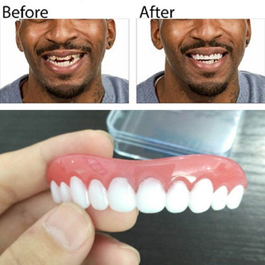 Perfect Instant Smile 1