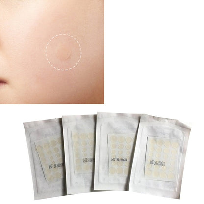 Beauty Acne Patch Set (24 PCS) 1