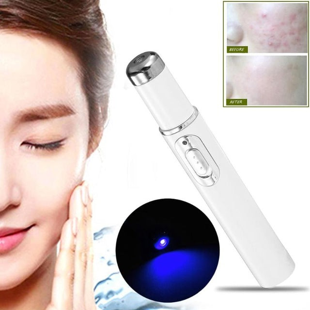 Skin Spots Removal Laze Pen 1