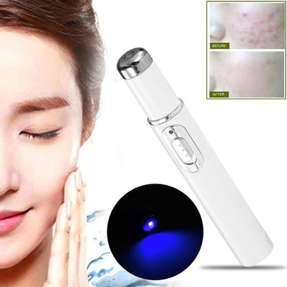 Skin Spots Removal Laze Pen 1