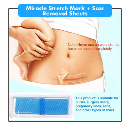 MIRACLE STRETCH MARK + SCAR REMOVAL SHEETS 1