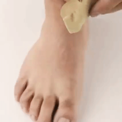 Bunion Corrector 1