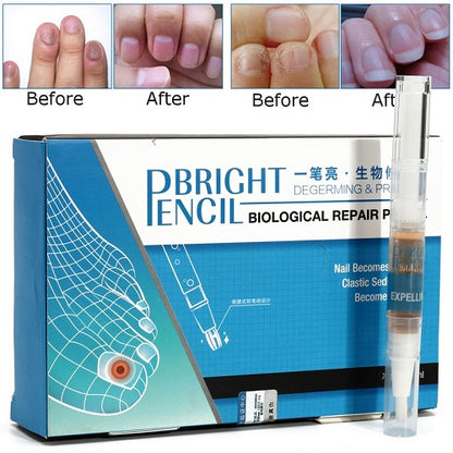 Eucony Fast Acting Toenail Cure - 3ml (PACK OF 4) 1